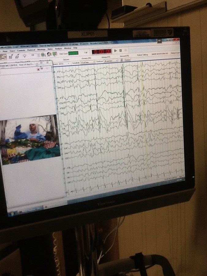 The monitor the EEG techs are watching and marking 24 hrs a day